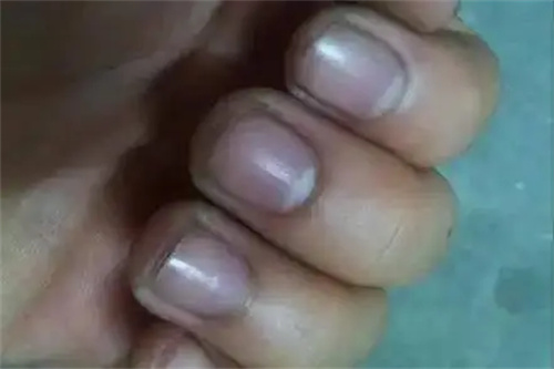图片细节说明